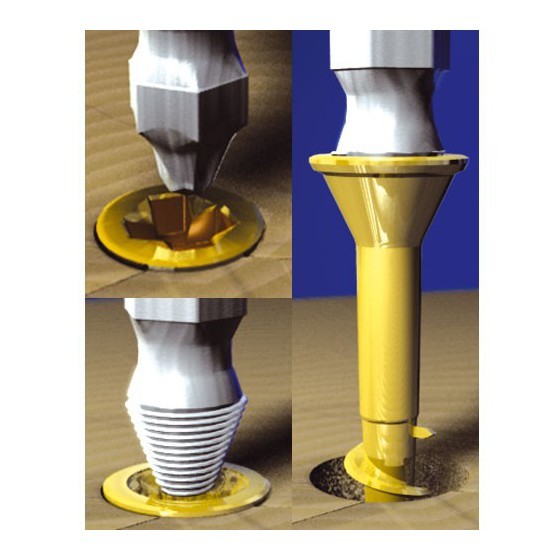 TREND GRAB/SE1/SET DAMAGED SCREW REMOVER SET